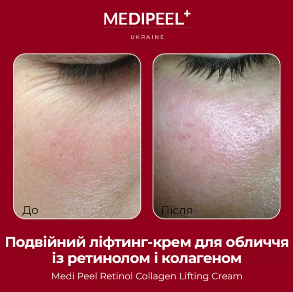 MEDIPEEL Подвійний ліфтинг-крем для обличчя із ретинолом і колагеном Retinol Collagen Lifting Cream, 50 мл 113830 фото